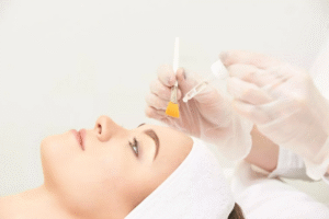 The Science Behind Chemical Peels: Riyadh Edition