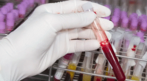 Blood Test at Home: Hygiene and Precautions