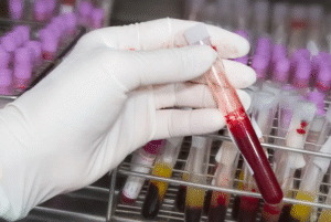 Blood Test at Home: Hygiene and Precautions