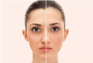 Dubai’s Non-Surgical Facelift Treatments for Fresh Skin