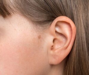 Latest Advances in Ear Plastic Surgery Riyadh