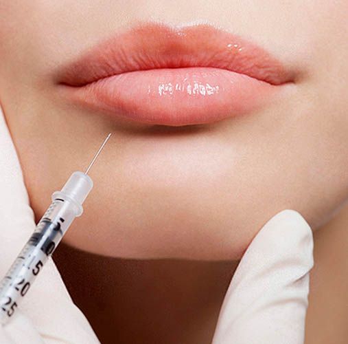 Safe Filler Injection Clinics in Riyadh