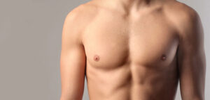 Common Misconceptions About Gynecomastia Surgery Debunked
