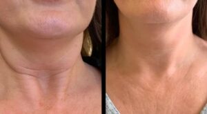Best Plastic Surgeons in dubai