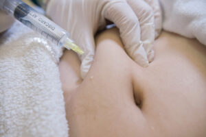 How Do Fat Melting Injections Work on Stubborn Fat?