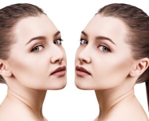 How Do Seasonal or Climate Factors Affect Rhinoplasty Recovery in Dubai?