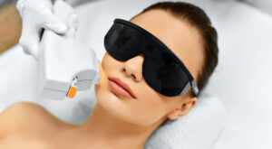 Laser Skincare Treatments