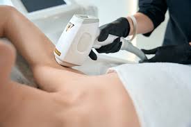 Frequently Asked Questions About Laser Hair Removal in Dubai