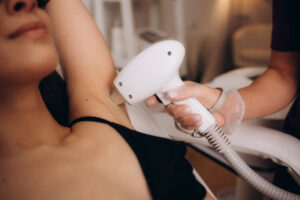 Full-Body Laser Hair Removal in Riyadh for Complete Smoothness