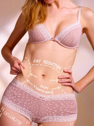 Laser Liposuction vs Diet and Exercise for Fat Removal