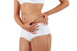 Liposuction Surgery in Riyadh: Tips for Choosing the Right Anesthesia