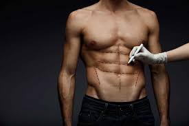 Liposuction Surgery in Dubai: How to Choose the Best Surgeon