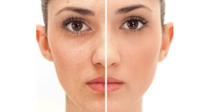 Nanobrows Mount Juliet – Achieve Natural, Long-Lasting Brows at Smart Touch Skin Solutions