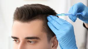 What to Expect During PRP Hair Treatment in Dubai