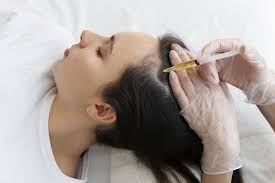 Understanding How PRP Hair Treatment in Dubai Promotes Hair Growth