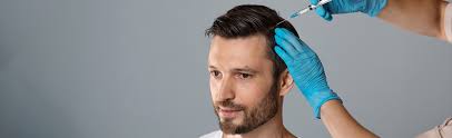 PRP Hair Treatment in Dubai: Everything You Should Know Before Starting