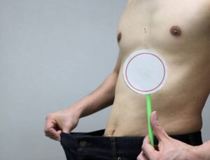 Innovations in Pain Management for Penile Enlargement Patients