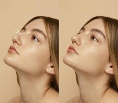 Rhinoplasty Surgery in Dubai: Common Myths and Facts You Should Know
