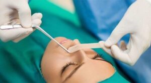 Riyadh Rhinoplasty: Refine Your Features