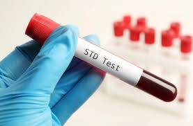 Understanding the Cost Factors of STD Test in Dubai