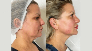 Best Aesthetic Clinic in Dubai: Where Your Glow Begins