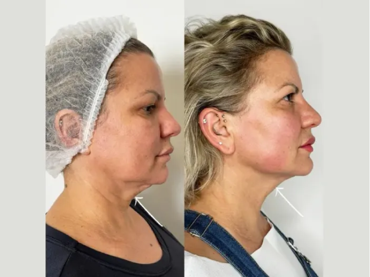 Best Aesthetic Clinic in Dubai: Where Your Glow Begins