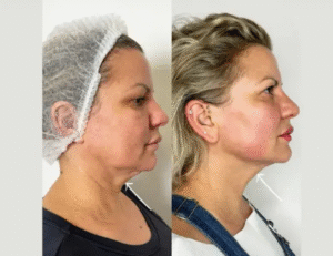 Best Aesthetic Clinics in Dubai for Body Contouring