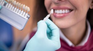 Step-by-Step Dental Veneers in Dubai: Before & After