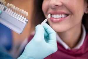 Step-by-Step Dental Veneers in Dubai: Before & After