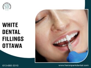 Top 5 Benefits of Professional Teeth Whitening Treatments