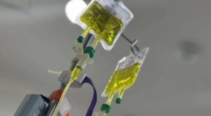 Can IV Drip Improve Your Concentration Fast?