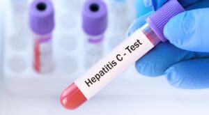 Hepatitis C Test
