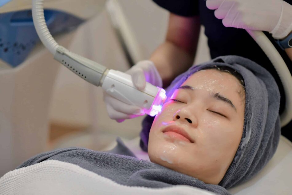 Laser Skincare Treatments