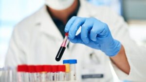 Why Everyone Should Try a Blood Test at Home Once