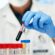 Why Everyone Should Try a Blood Test at Home Once