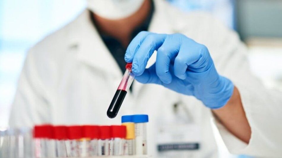 Why Everyone Should Try a Blood Test at Home Once