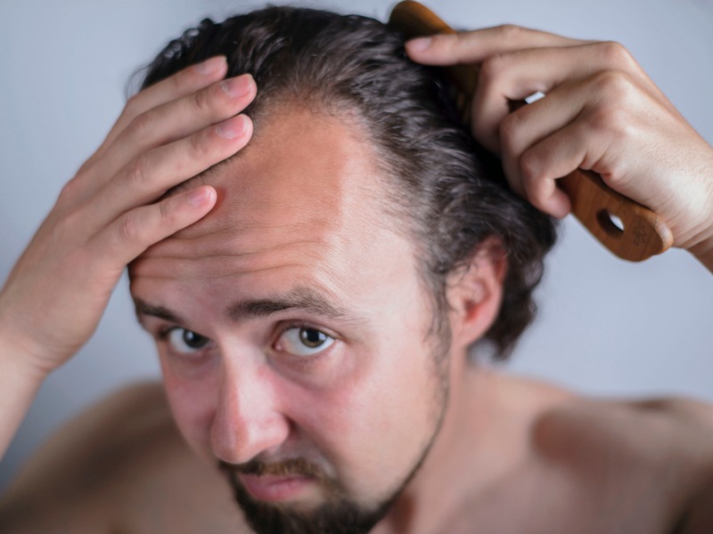 Finasteride 1mg for hair loss