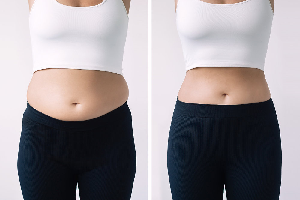 Weight Loss Clinic
