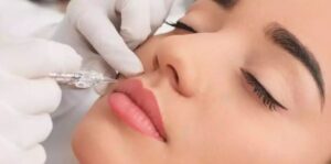Transform Your Smile with Best Lip Fillers Injections Safely