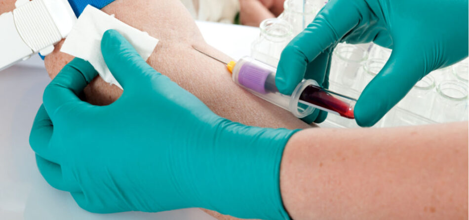 Blood Test at Home for Diet Optimization