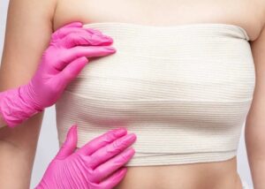 Top Questions to Ask During a Breast Reduction Consultation in Riyadh