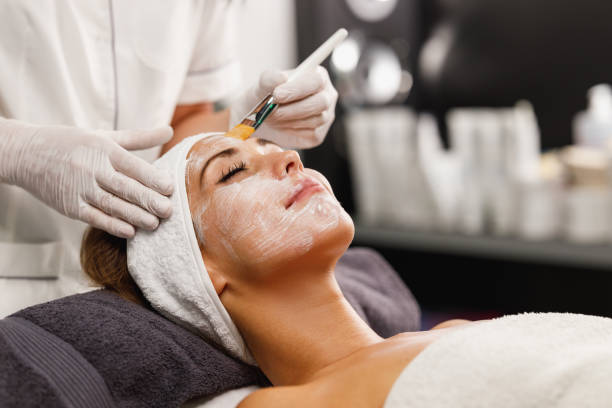 Expert Chemical Peels for Acne Scars