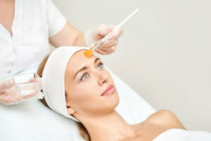 Chemical Peels in Dubai for Smooth Complexion