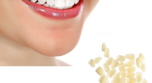 Composite Veneers Dubai: Affordable Cosmetic Option