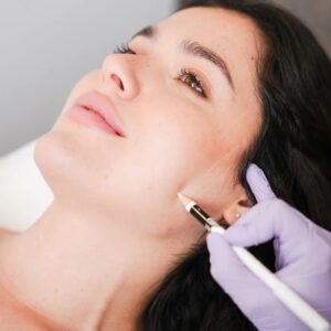 Targeted Enzyme Treatments for Acne and Breakouts