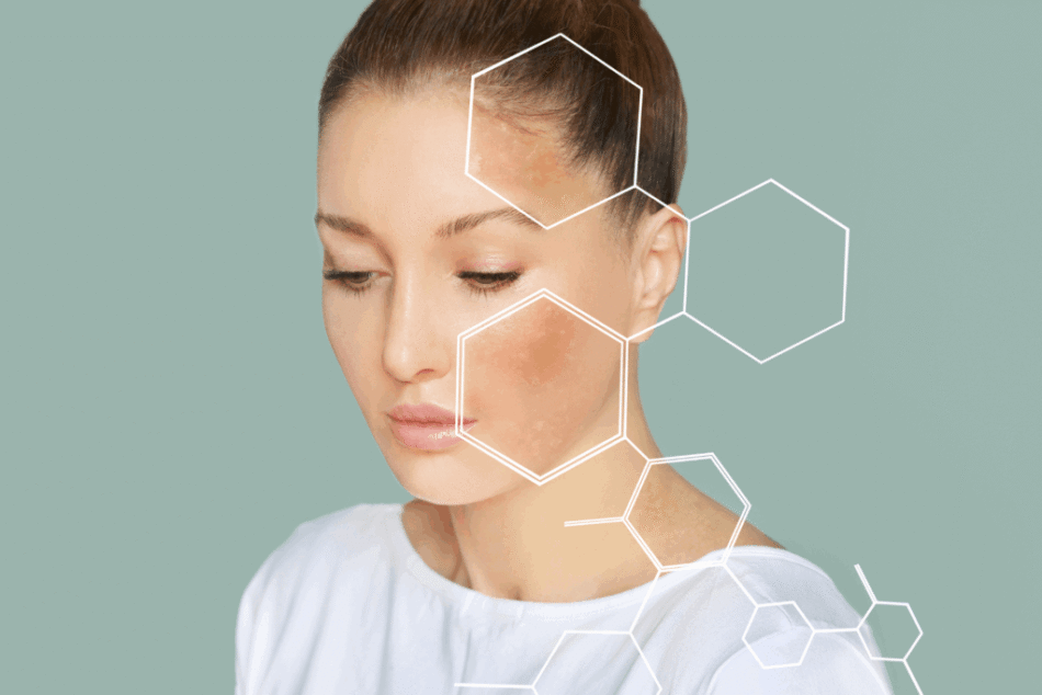 How Dermatologists Use Chemical Peels and Microneedling for Skin Renewal