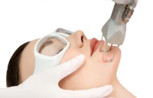 Dubai Laser Treatment for Uneven Skin Tone