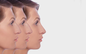 Dubai Rhinoplasty Clinics with Best Patient Reviews