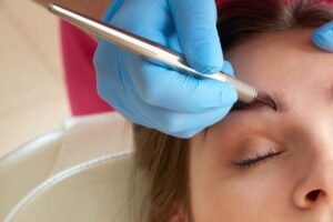 Understanding Electrolysis Hair Removal Fees
