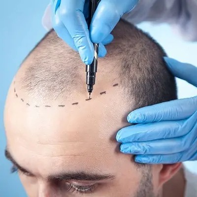 Front Line Hair Fixing